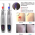 Miniatura - Aparelho Caneta Laser Remove Mancha Tatuagem Profissional vermelha Original